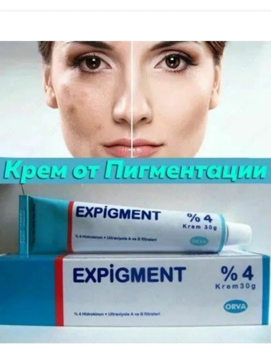 Крем от пигментации expigment. Отбеливающий крем expigment 4. Крем от пигментации экспигмент expigment 4. Турецкий отбеливающий крем expigment.