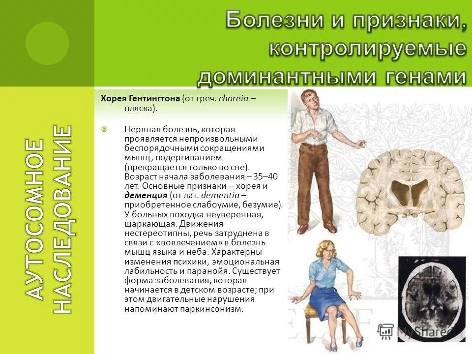 Хорея хантингтона