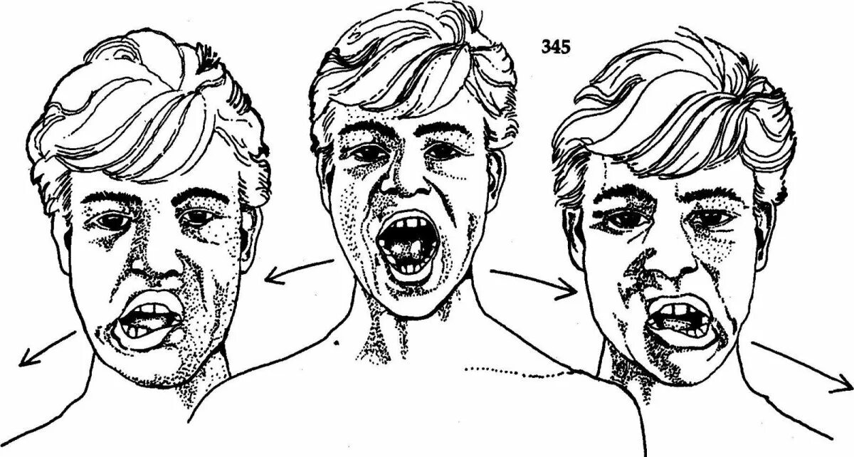 Открывая рот в мою сторону. Круговые движения челюстью. Движение нижней челюсти в сторону. Смещение подбородка вправо.