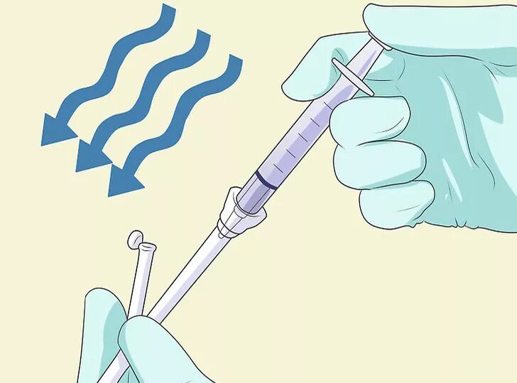 Как вставить зонд. Введение тонкого желудочного зонда. зонд желудочный как ставить.