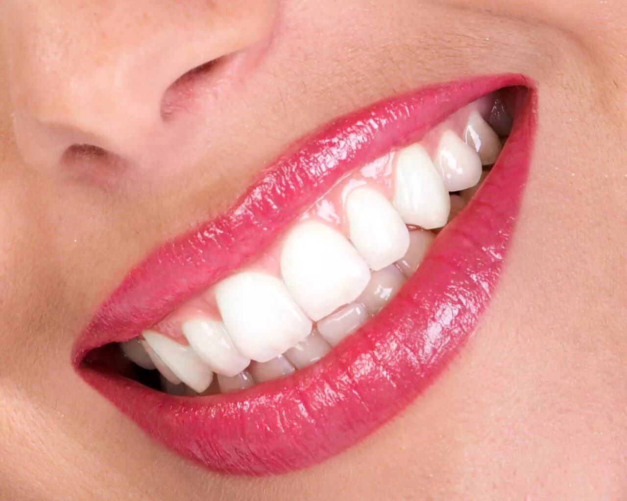 Красивые зубы. Идеальные зубы. Белоснежная улыбка. Красивая улыбка. Идеальные зубы.