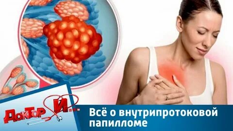 Как лечить мастопатию молочных желез