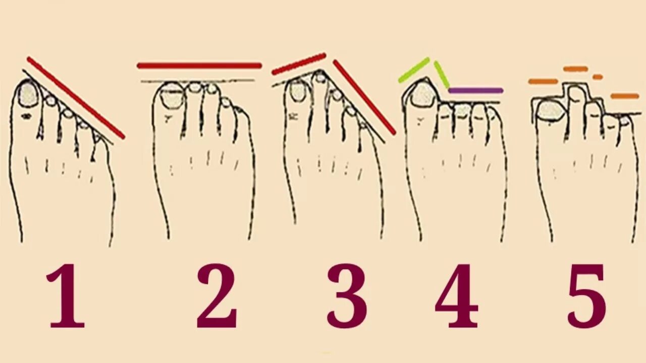 Какие бывают пальцы ног. Форма пальцев на ногах. Характер по пальцам ног. Форма расположения пальцев на ногах. Типы пальцев на ногах и характер.
