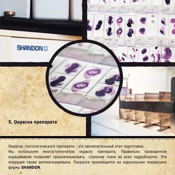 Гистологическая техника специальные методы окраски. Типы окраски препаратов гистология. Окраска гистологических срезов по перлсу. Патологическая анатомия пневмоцистной пневмонии. Гистологическая техника специальные методы окраски.