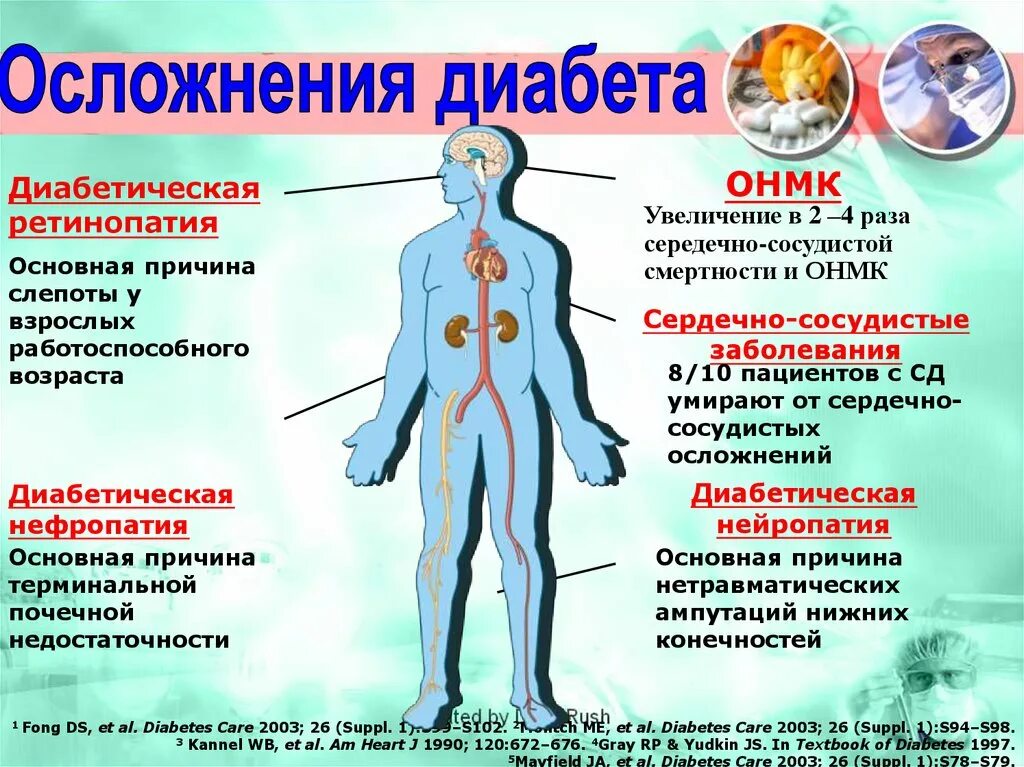 Осложнения раз. Эндокринная система сахарный диабет. Опасность сахарного диабета. Заболевания эндокринной системы сахарный диабет. Сахарный диабет это заболевание.