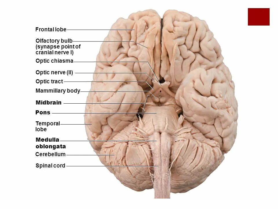 Medulla Oblongata анатомия. Наружная поверхность головного мозга. Препарат мозга анатомия. Нижнее основание головного мозга. Мозг снизу