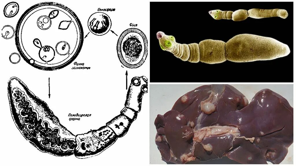 Может ли человек заразиться эхинококком. Ленточные черви эхинококк. Ленточный червь эхинококк. Ленточный червь альвеококк.