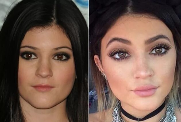 Pin by Sara Yun on SEPS 303 Ideals for Appearance Kylie jenner plastic surgery, 