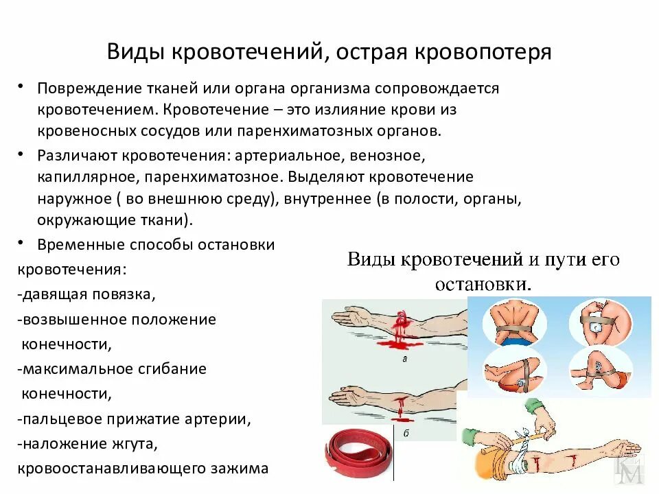 Таблица виды кровотечений признаки и первая помощь. Ответы кровотечения бывают следующих видов. Венозное кровотечение схема. Основные виды кровотечений обж. Таблица вид кровотечения краткая характеристика способы остановки.