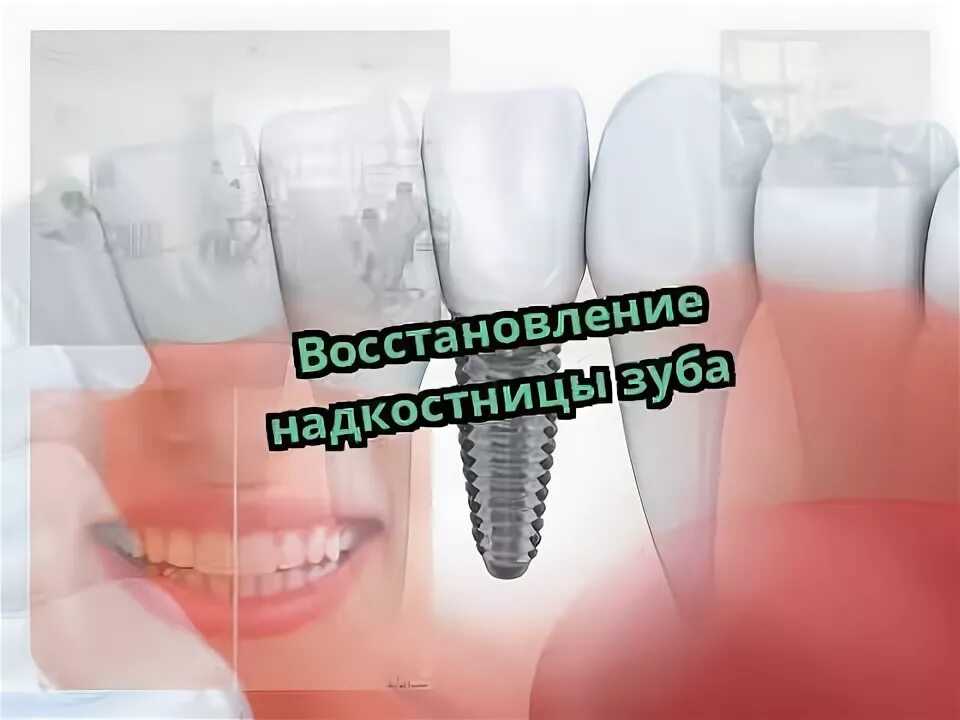 Воспаление надкостницы зуба - CollectPhoto.ru