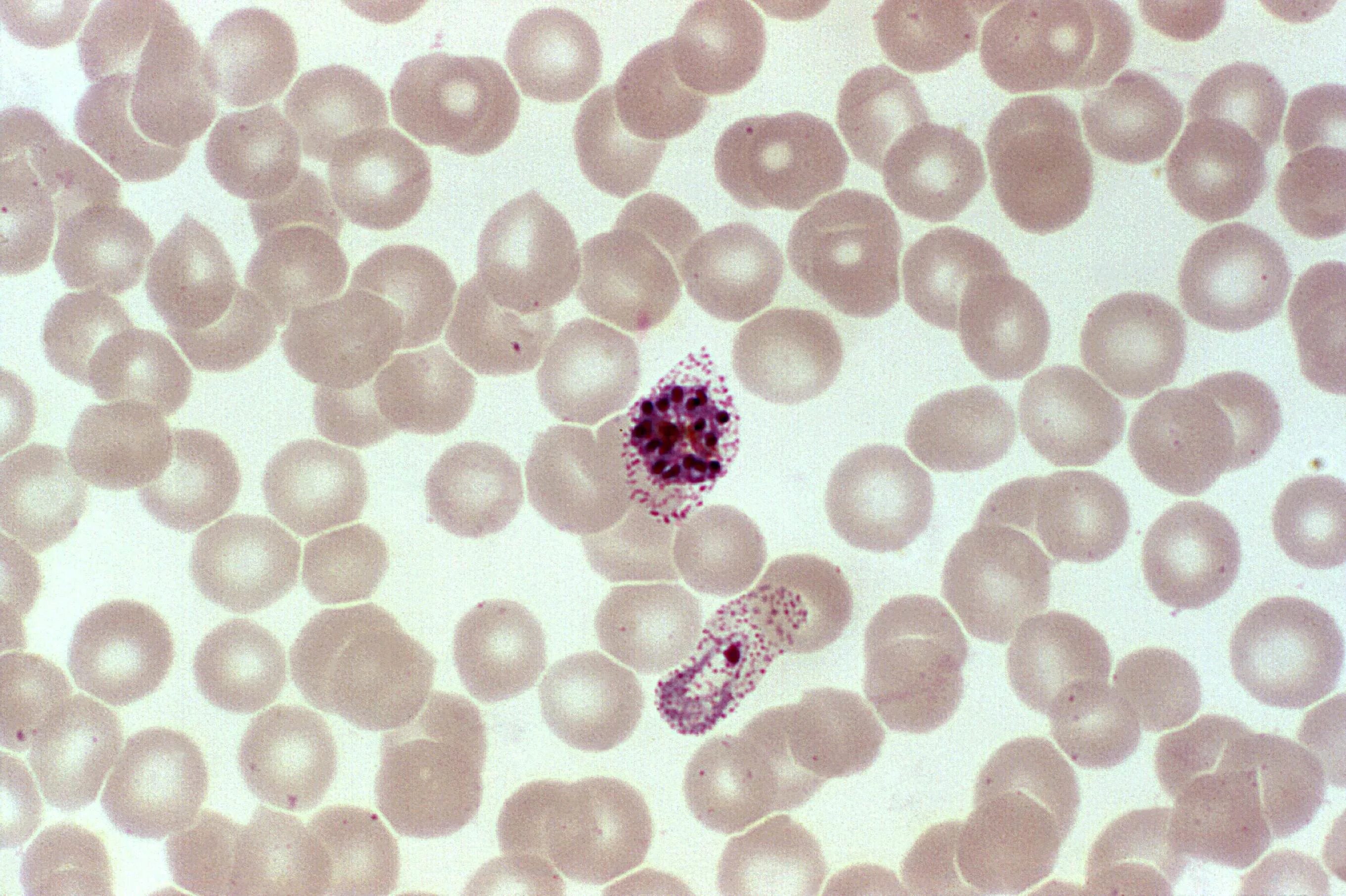 Малярия клетки. Плазмодий Vivax. Малярийный плазмодий Вивакс. Плазмодиум малярия Plasmodium malariae. Плазмодиум Vivax.