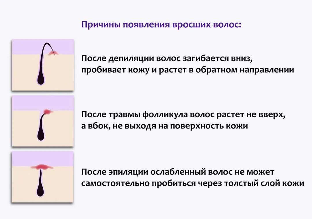 Можно делать шугаринг при месячных