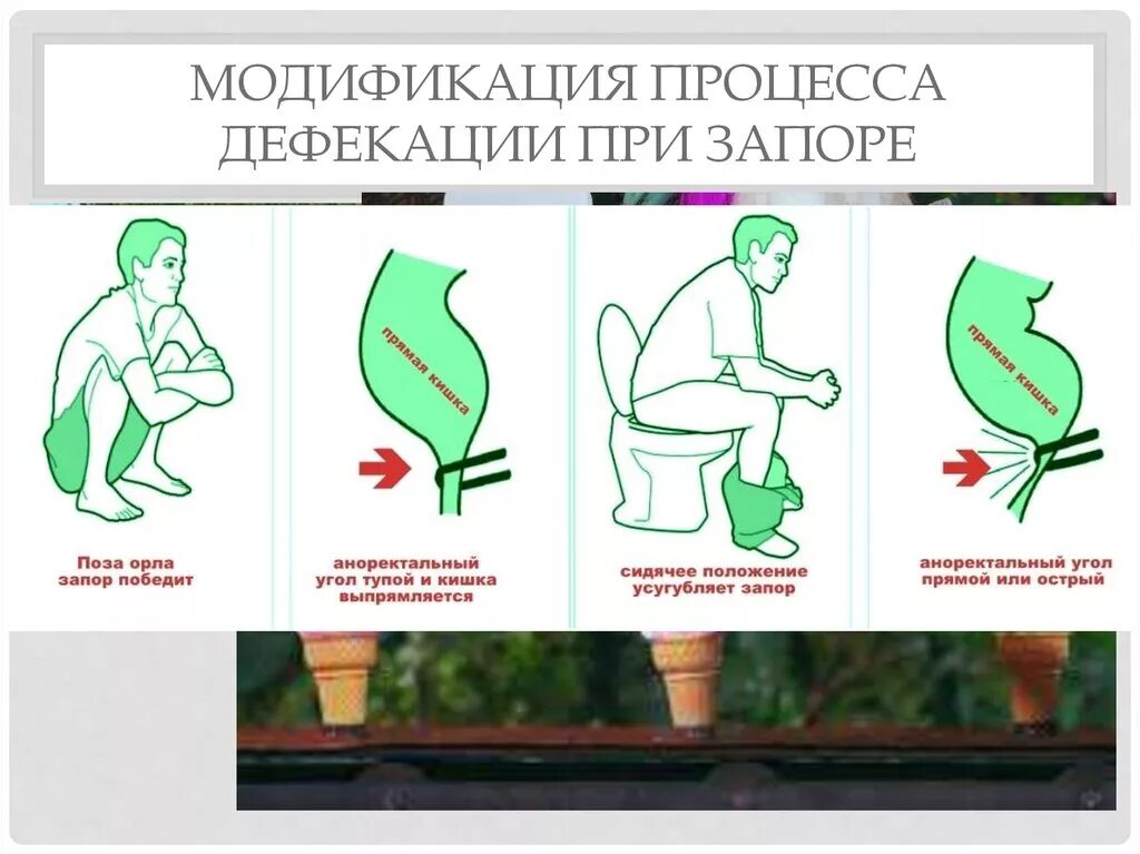 Дефекация при запоре. Правильная поза для опорожнения. Правильная поза при запоре. Правильная поза для опорожнения кишечника. Правильная поза для дефекации при запоре.