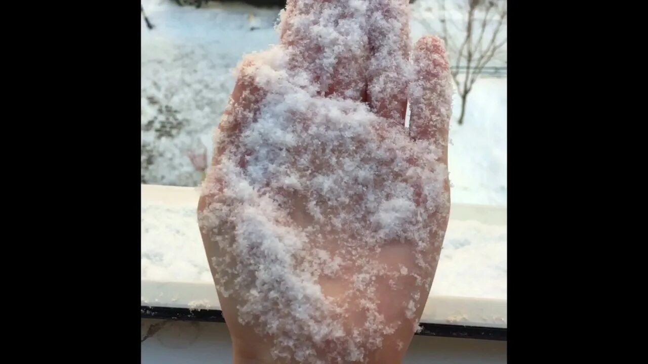Аллергия на таяние снега. Тает снег в руках. Тают на руках. Снежинка тает на руке.
