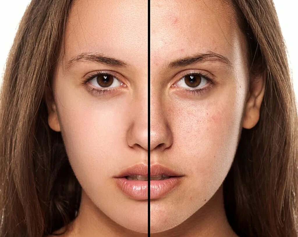 Приложения для ретуши кожи. Программы для обработки фотографий. Фотографии для обработки в фотошопе. Фото для ретуши в фотошопе. Лицо для обработки.