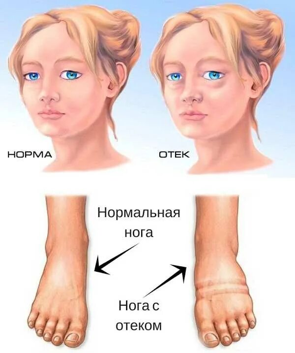 Как выглядит как проходит