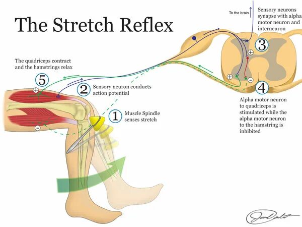 Стрейч рефлекс. Alpha Motor neuron. Стрейч рефлекс мышцы. Стопный рефлекс Вестфаля.