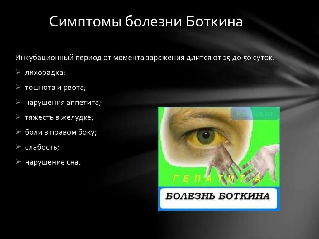 Признаки заболевания гепатитом. Гепатит а болезнь Боткина. Желтуха болезнь Боткина.