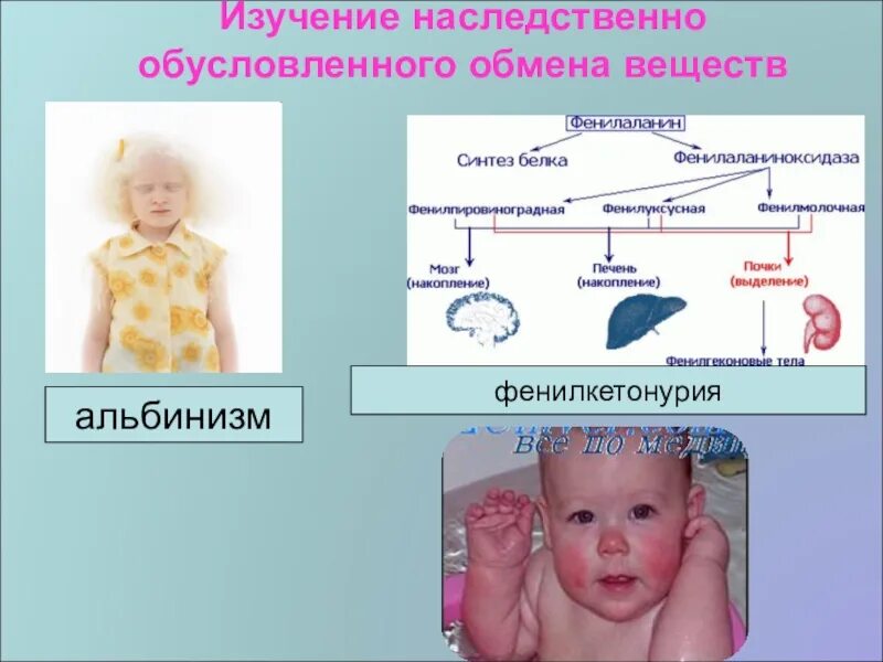 Фенилкетонурия моногенное заболевание егэ. Фенилкетонурия моногенное заболевание. галактоземия это наследственное заболевание. наследственные заболевания обмена веществ фенилкетонурия.