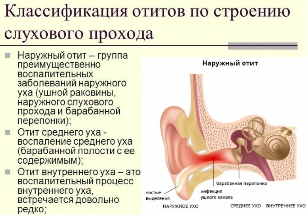 Отит уха лечение антибиотиками. Острый наружный средний отит. Наружный отит воспаление. Заболевания наружного уха отит наружный. Средний и наружный отит симптомы.