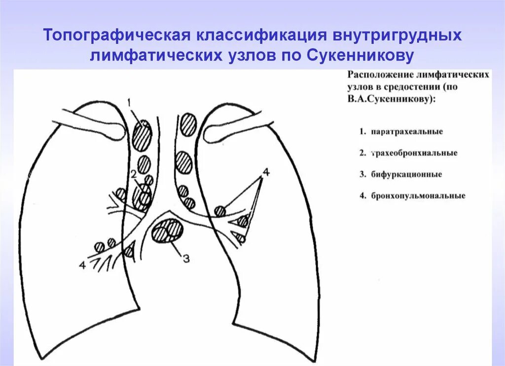 Лечение лимфоузла легкого. Туберкулез внутригрудных лимфатических узлов схема. Группы лимфоузлов средостения схема. Внутригрудные лимфоузлы схема. Лимфатические узлы средостения схема.