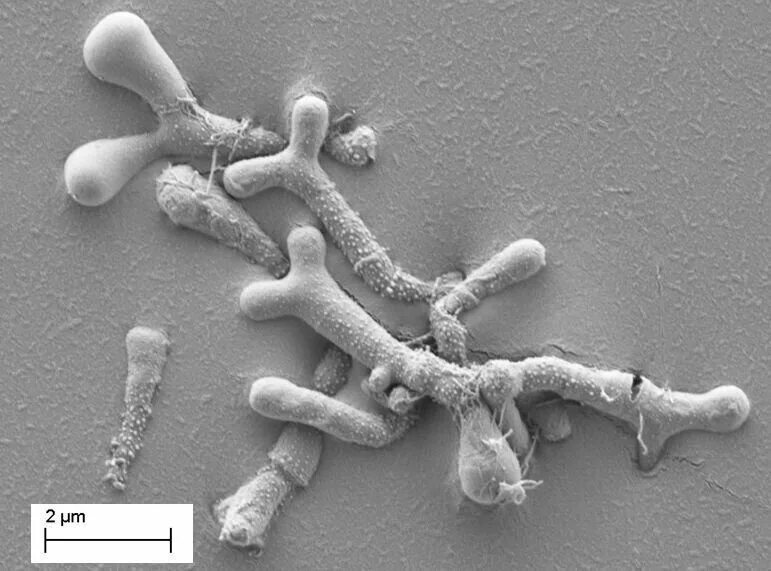 Палочка бифидобактерии. Bifidobacterium bifidum под микроскопом. Bifidobacterium bifidum. Бифидобактерии (bifidum adolescentis). Микробиота бифидобактерии.
