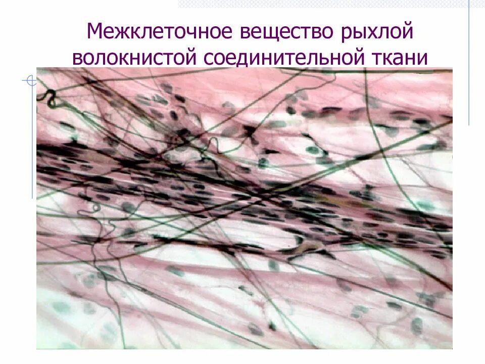 Межклеточное вещество находится. Межклеточное вещество рыхлой волокнистой соединительной ткани. Межклеточное вещество рыхлой соединительной ткани препарат. Волокна рыхлой волокнистой соединительной ткани. Основное аморфное вещество рыхлой волокнистой соединительной ткани.