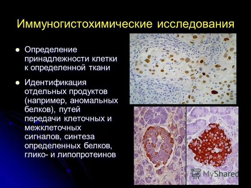 Игх-исследование. Иммуногистохимическое исследование. Иммуногистохимическое исследование опухоли. Эндомиокардиальный фиброз гистология. Мги игх.