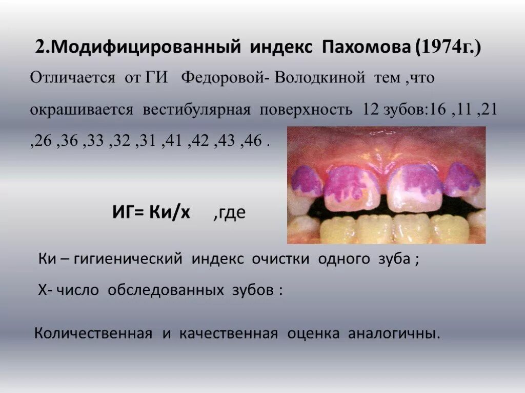 Гигиенические индексы полости. Индекс гигиены. Индексы в стоматологии. Индекс гигиены в стоматологии.