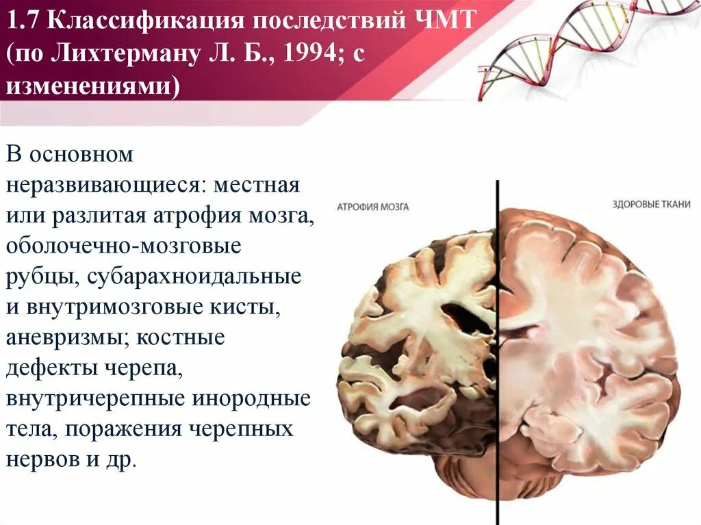 Атрофия головного мозга 1. ЧМТ сотрясение головного мозга. Последствия ЧМТ классификация. Классификация черепной травмы. Классификация внутричерепных травм.