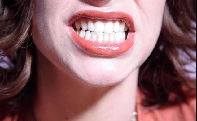 Зуб с волшебной палочкой. Летающие зубы. Летающие зубы. Красивые зубы. Логотип ракета с зубами.