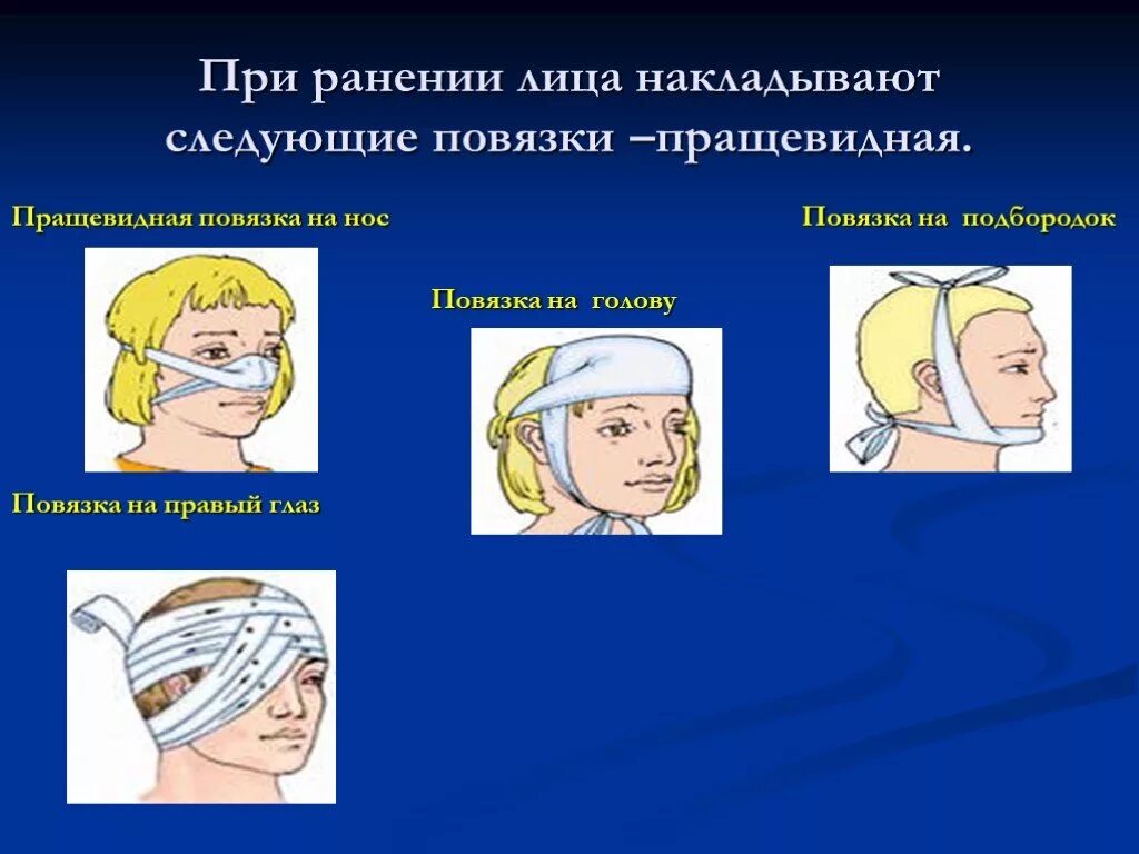 Наложение повязки при травме головы. Пращевидная повязка. При ранении в области лица накладывается повязка. Пращевидная повязка на нос.