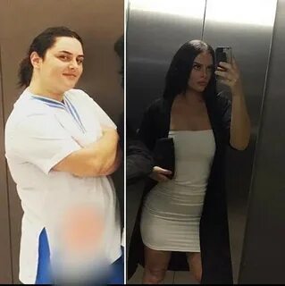 Sadece tüp mide ameliyatı değil, estetikleri de konuşuldu Yaren'in. 