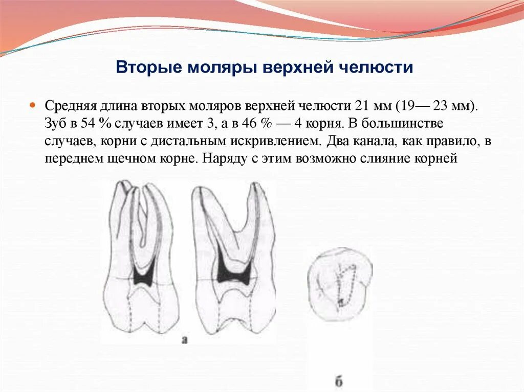 Первый моляр верхней челюсти. Второй моляр верхней челюсти каналы. Топография полости вторых моляров челюсти. Топография полости зуба 2 моляра верхней челюсти. Второй моляр верхней челюсти анатомия каналов.