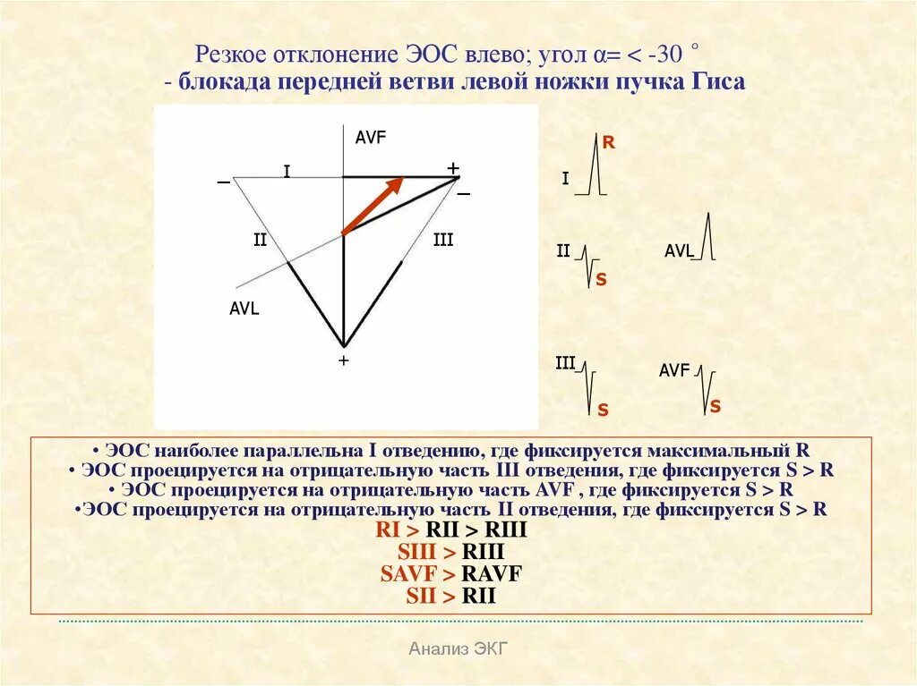 Сердце отклонено вправо. Отклонение ЭОС влево. Резкое отклонение ЭОС влево что это. Отклонение ЭОС влево на ЭКГ. Отклонение электрической оси влево на ЭКГ.