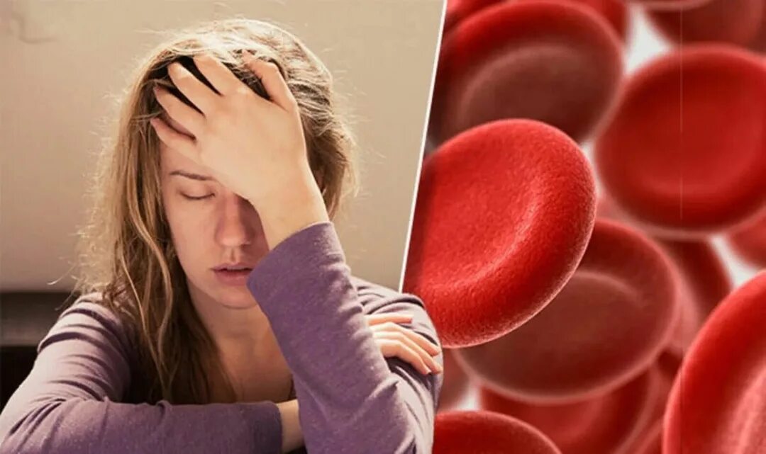 Пациент с железодефицитной анемией. Пациент с железодефицитной анемией