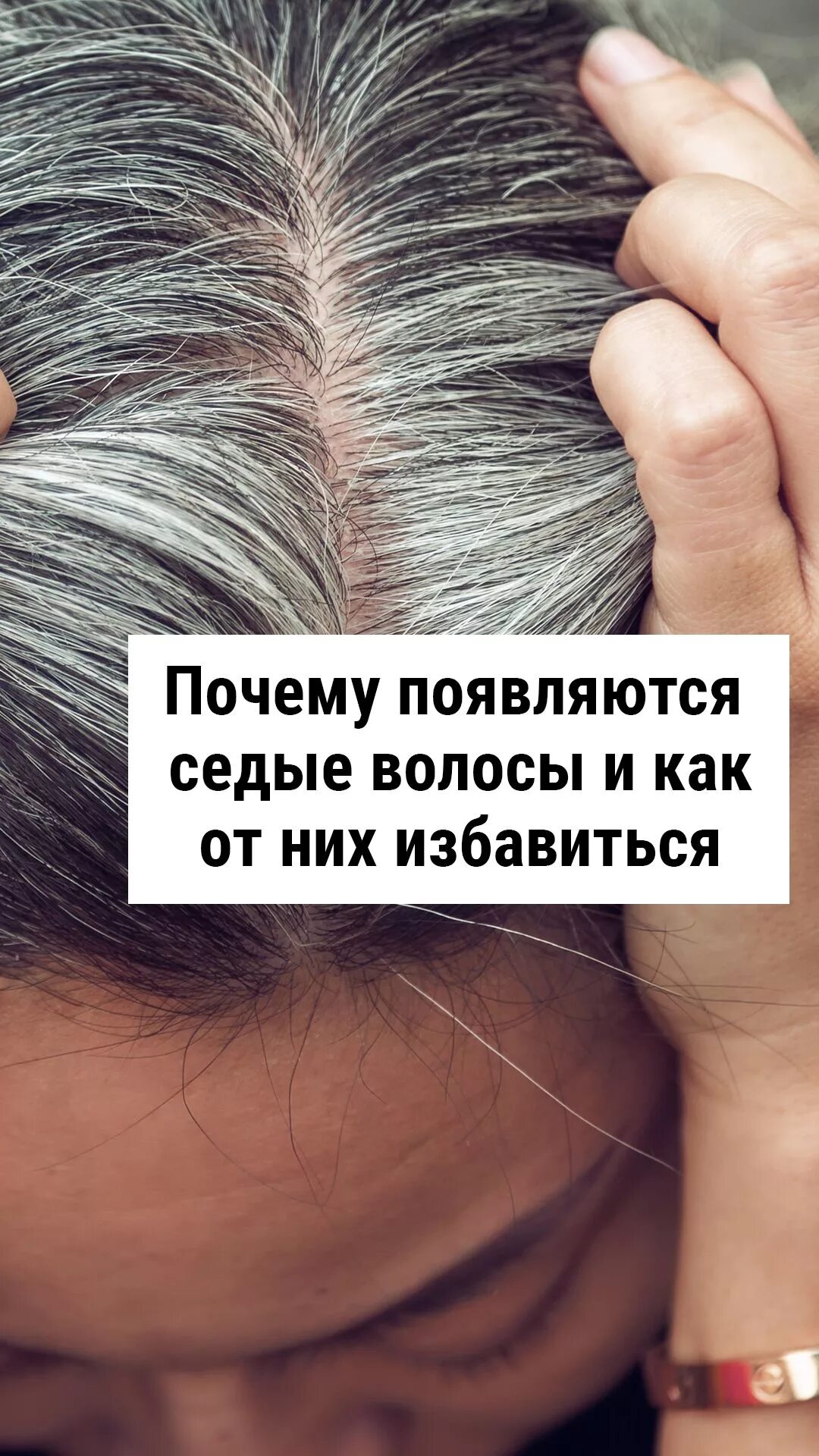 Раннее поседение волос. Преждевременное поседение волос. Волосы с проседью. Седые волосы со спины. Седые волосы.