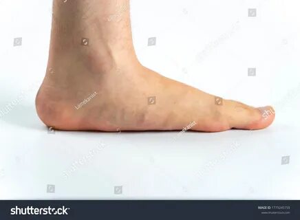 Flat footed