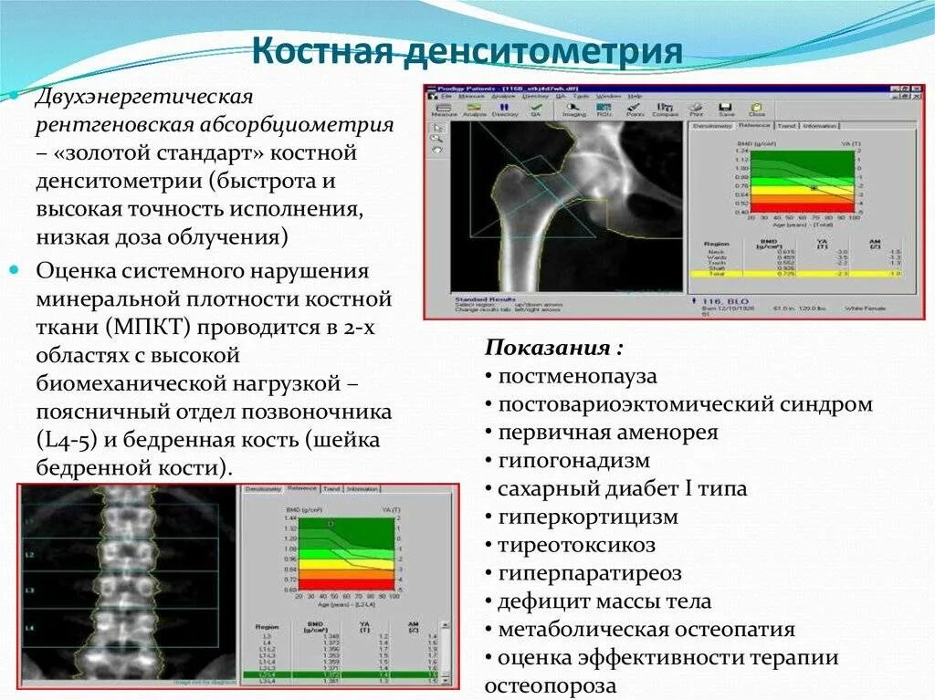 Денситометрия тазобедренных суставов и поясничного отдела позвоночника. Исследование на остеопороз денситометрия. Исследование плотности костей денситометрия. Денситометрия поясничного отдела остеопороз. Рентгеновская денситометрия бедренной кости.