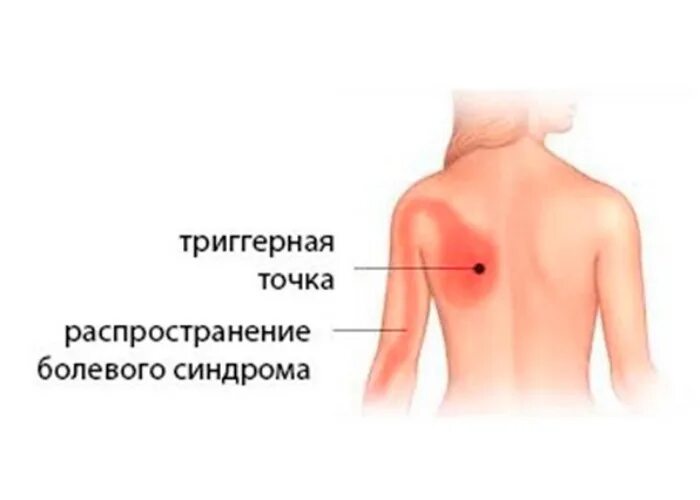 Лёгкие со стороны спины. Болит левая лопатка чем лечить. Болит левая лопатка чем лечить. Мышца под левой лопаткой. Боль между лопаток упражнения.