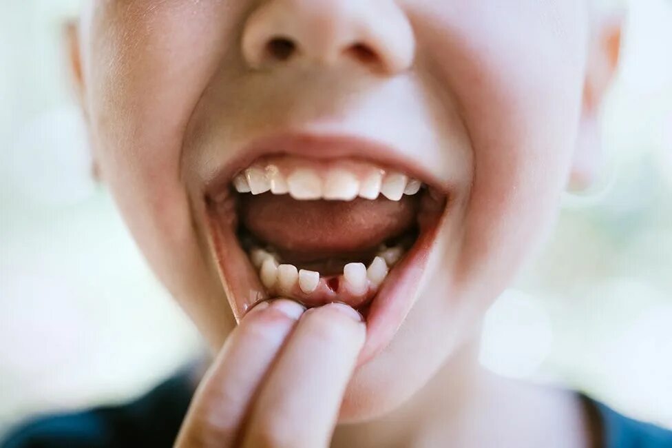 Doctors Are Urging Parents Everywhere To Keep Their Kids' Baby Teeth Baby teeth,