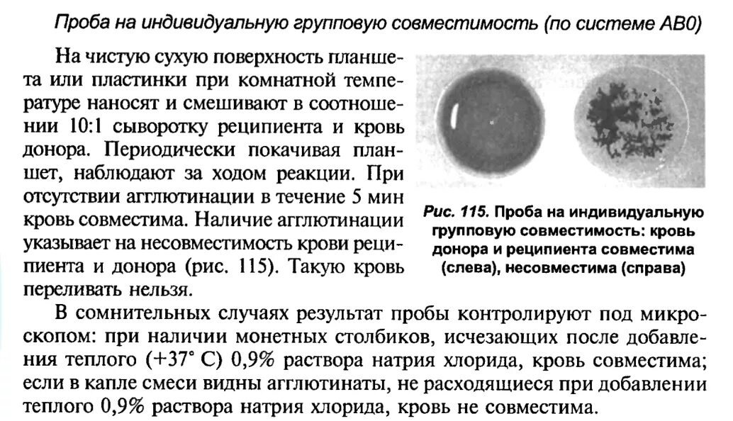 Проведение проб на индивидуальную совместимость крови. Проба на индивидуальную совместимость крови по системе АВО. Проведение пробы на групповую совместимость. Провести пробу на индивидуальную групповую совместимость. Сухая проба