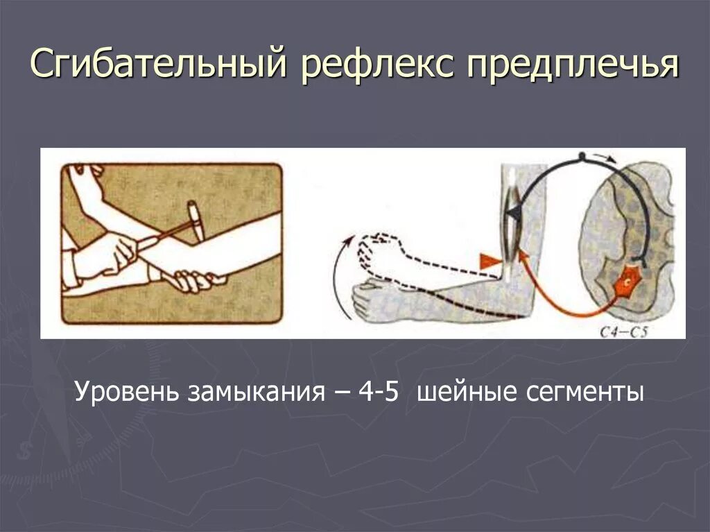 Сгибательный рефлекс физиология. Сгибательный рефлекс предплечья физиология. Сгибательные рефлексы спинного мозга. Схема дуги сгибательно-локтевой рефлекс,.