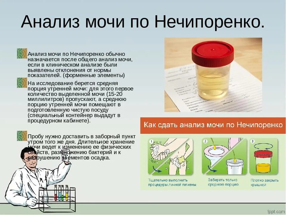 За сколько можно собрать мочу. Исследование мочи по методу Нечипоренко. Моча используется для исследования по методу Нечипоренко. Для исследования по Нечипоренко мочу собирают. Порция мочи для исследования по Нечипоренко.