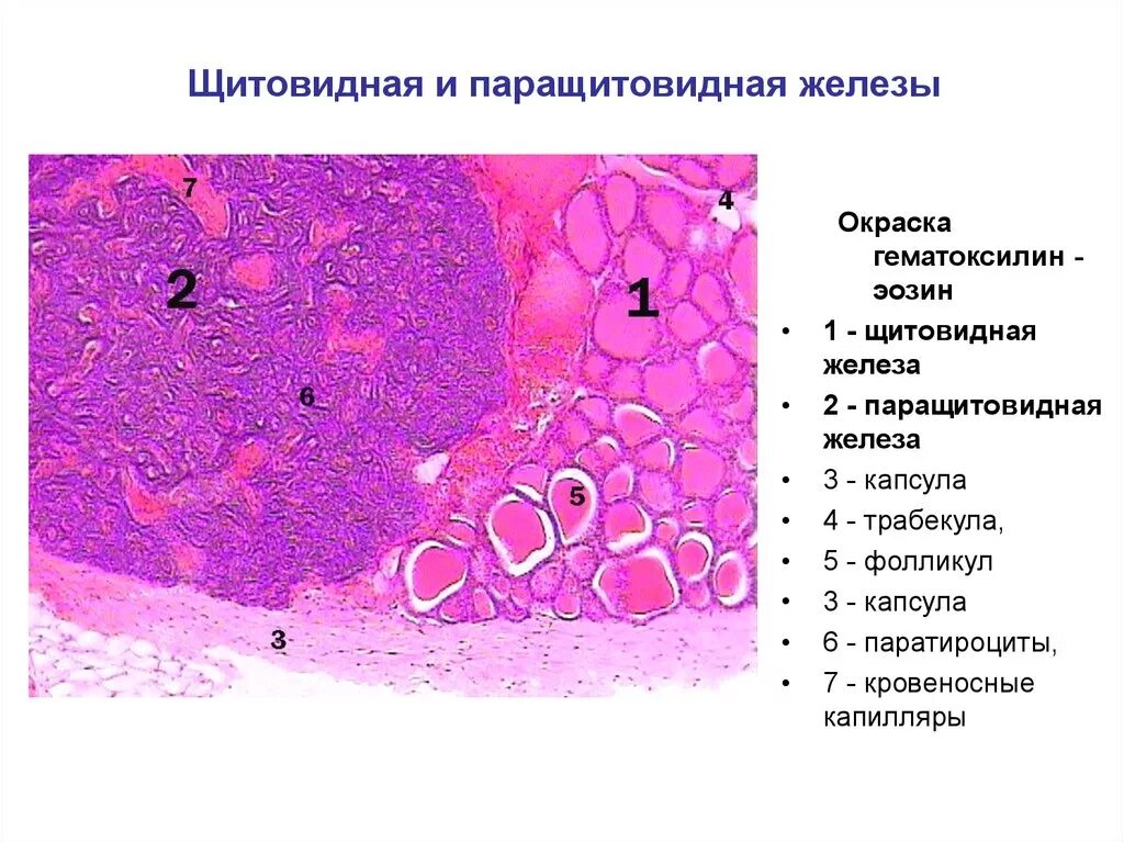 Срез щитовидной железы. Паращитовидная железа гистология препарат. Щитовидная и паращитовидная железы гистология. Препарат – щитовидная железа. Окраска гематоксилин-эозином.. Щитовидная и паращитовидная железа гистология препарат.