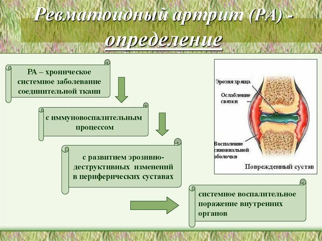 Болезни костной мышечной и соединительной ткани. Системные заболевания соединительной ткани. сестринский процесс при артрите. системные поражения соединительной ткани. системные заболевания соединительной ткани классификация.
