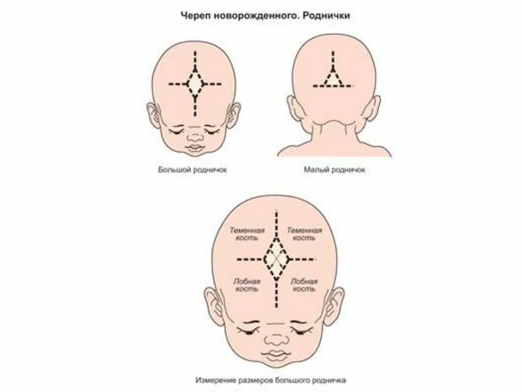 Роднички какие. Родничок у новорожденных. Темечко на голове у младенца. Родничок на голове у новорожденных.