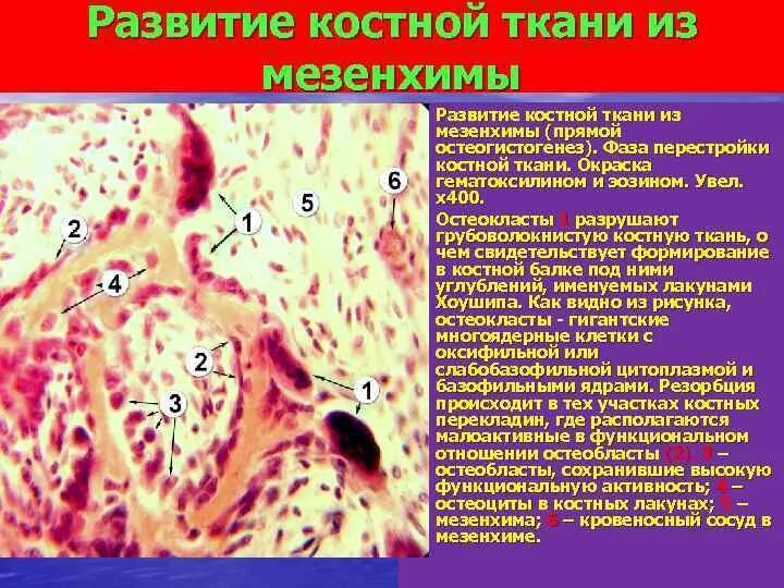 Развитие костной ткани прямой остеогенез. Ретикулофиброзная костная мозоль. Этапы развития костей. Развитие костей. Костное формирование.