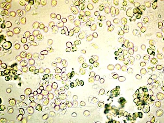 Дрожжевые клетки в моче повышены. Пекарские дрожжи Saccharomyces cerevisiae. Дрожжи Saccharomyces микроскопия. Дрожжевые грибы микроскопия мочи. Микроскопия кала дрожжи.