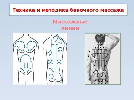 Схема массажа банкой
